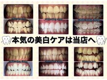 ホワイトニングショップ 今治店の雰囲気（回数を重ねるごとにどんどん歯を白く☆☆）