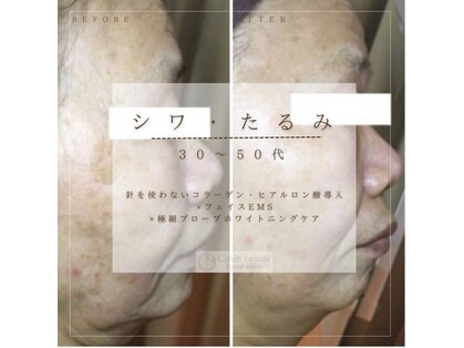 カロンボーテ(Calon beaute)の写真
