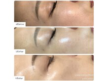 ラグ(LUXU)/大人肌の為の肌育