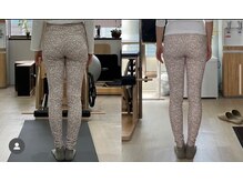 エウレカ(eureka)/下半身痩せ