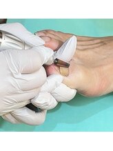 巻き爪補正店 鎌倉大船店/3.厚み、根本の調整を行う