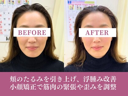 まいれ整骨院 東近江院の写真