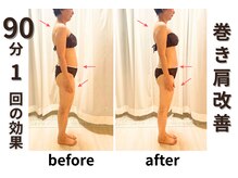 ゼロン(zelon)/巻き肩改善