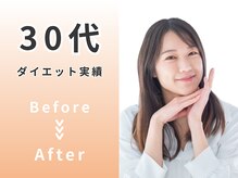 シーワイビー(C.Y.B)/30代 ダイエットBefore/After
