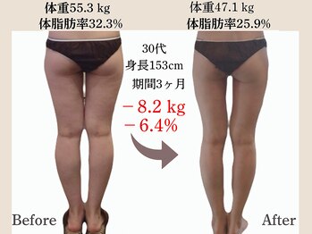 プレジィール 小顔 痩身専門店(PlaisiR)