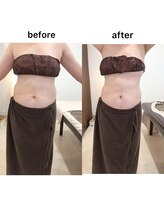 ジョワイユ(Joyeux)/腸の位置でお腹は変わる