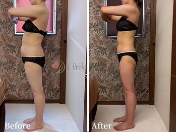 ワールドビューティー(World Beauty)/滝汗デトックス×強圧リンパ痩身