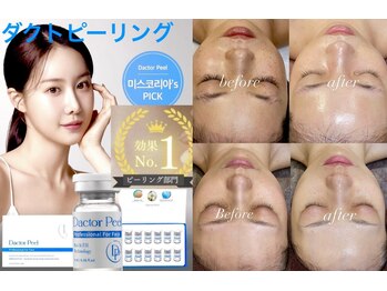 レシェルサロン(Lechelle Salon)/ダクトピーリング