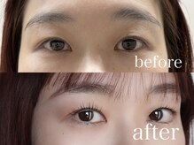 シエナ アイ(CIENA eye)/