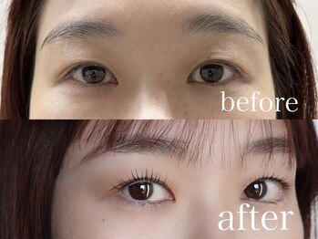 シエナ アイ(CIENA eye)/