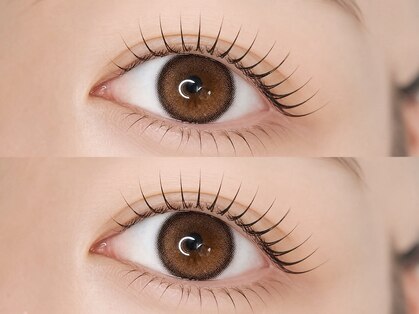 アイミーアイビューティー 宇都宮本店(ime eye beauty)の写真