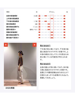 ゆうしん整骨院 森下/前後左右どこにずれているのか