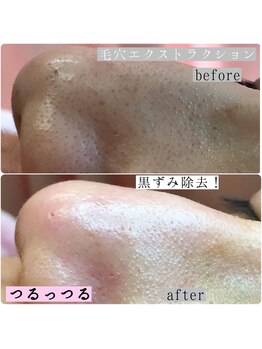 鎌倉美肌シェービングルーム あじさい/