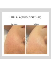 ポムハヌル(pom.haneul)/韓国肌管理室