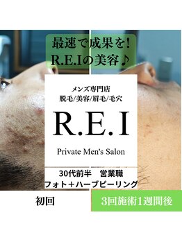 レイ(R.E.I)/30代後半／ニキビケア／3回