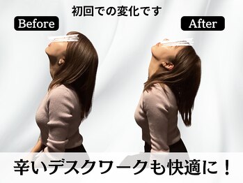 ハリユナイテッド 原宿鍼灸 整体院(HALI UNITED)/辛いデスクワークも快適に!
