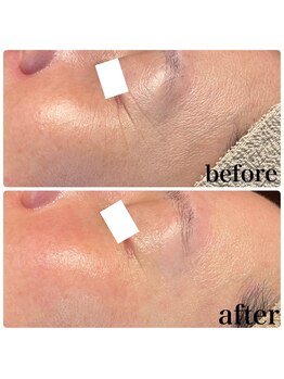 ディオーネ 春日井勝川店(Dione)/マーメイドセルトリートメント