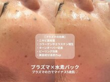 ピブ(pib.)/プラズマってすごいんです！