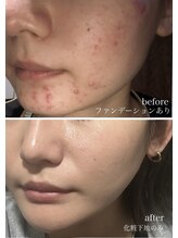 クラン 森ノ宮店(Clan)/DRPL　30代女性