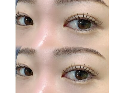 シュナ(SCHNA)の写真