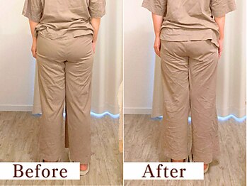 ユルビノ 武蔵小杉(yurubino)/Y様/デスクワーカー/30代女性