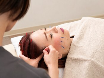 ゆうだい整骨院の写真/美容鍼＋高密着幹細胞パック。写真映りも肌も気になる40代50代へ、仕上げまでしっかりケア
