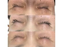 ステラ(Stella)/お顔のトーンが変わります。