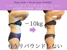 シャルム(charme)/結果出しハイパーナイフ痩身
