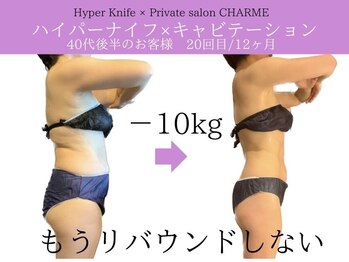 シャルム(charme)/結果出しハイパーナイフ痩身