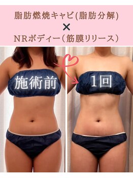 ココロ(COCORO)/1回の施術です♪