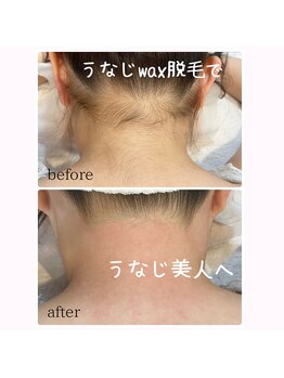 サロン ド モモ(salon de momo)/うなじデザインwax脱毛