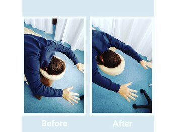 プラスト(PLUST)/肩関節の可動域改善