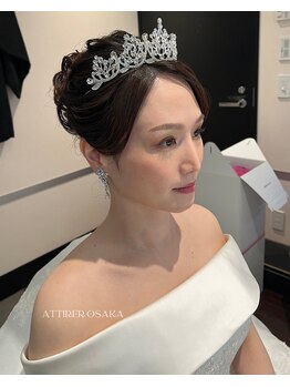 アティレ オオサカ(Attirer Osaka)/施術後のフィッティング経過