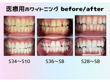 麗 御徒町の雰囲気（ホワイトニングbefore/after♪[ホワイトニング/御徒町]）