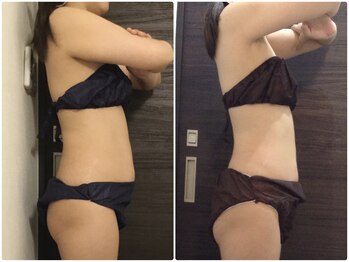 ウェリナ平和堂長久手院/小顔矯正/骨盤矯正/美脚サロン