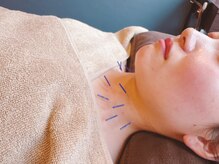 高田馬場はりきゅう院/喉への鍼灸