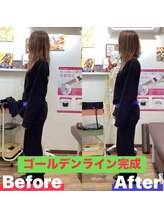 ヒデ整体院(Hide整体院)/産後骨盤矯正で歪み腰痛開き改善