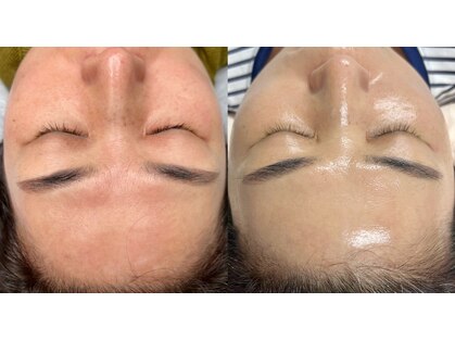 キムズエステティックサロン(Kim's aesthetic salon)の写真