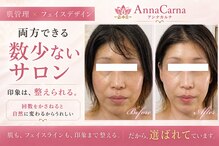 アンナカルナ(AnnaCarna)