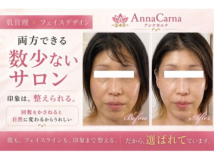 アンナカルナ(AnnaCarna)の写真