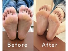 グリーングリーン(GREEN GREEN)/ドイツ式フットケア