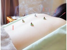 かわい指圧ルーム/≪鍼灸コース≫