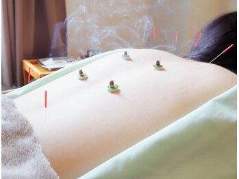 かわい指圧ルーム/≪鍼灸コース≫