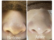 オレンジ(Orange)/【鼻専用】毛穴・角質ケア60分