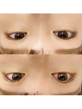 アイクイーン 亀戸(Eyequeen)/