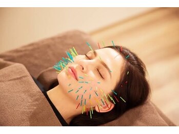 スタイル鍼灸接骨院の写真/頭蓋骨矯正＋美容鍼+小顔フェイシャルを組み合わせた当院オリジナルメニューで小顔になれる贅沢コース有♪
