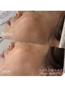 プリンセスローズ 焼津店(Princess Rose)/ムートン泡エステ