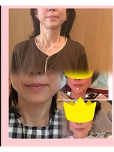 ルクシア(Luxia)/お首の歪みに長年のお悩み