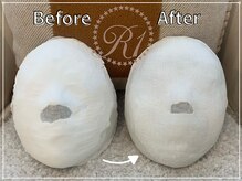 R-1ビューティーサロン 銀座/BEFORE＆AFTER　