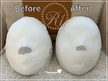 R-1ビューティーサロン 銀座/BEFORE＆AFTER　